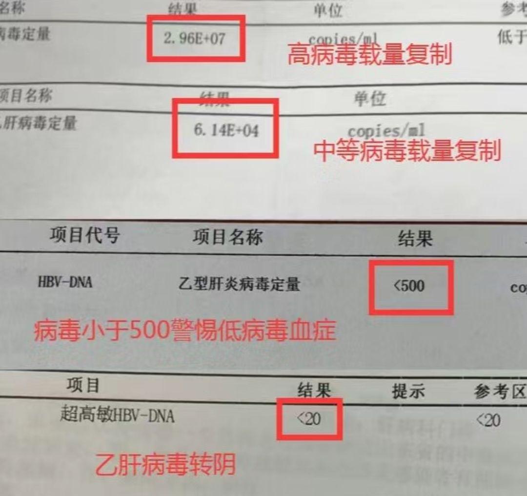 乙肝病毒量降到多少才安全？ 临床上通常将乙肝病毒量分为四个阶段： 第一...