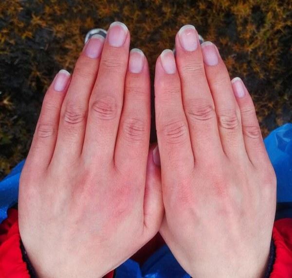 手冻红了能用热水浸泡吗？转发提醒！手冻红了切忌用热水浸泡

寒冬腊月，户外活动变