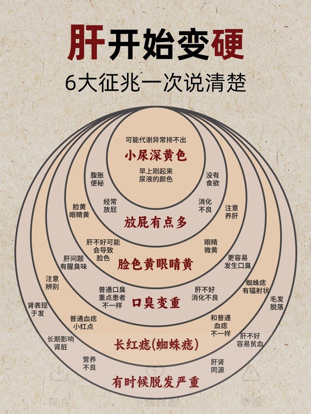 肝开始变硬的6个信号，一次性说清楚！
肝脏健康直接影响身体状态，如果出现这些表现
