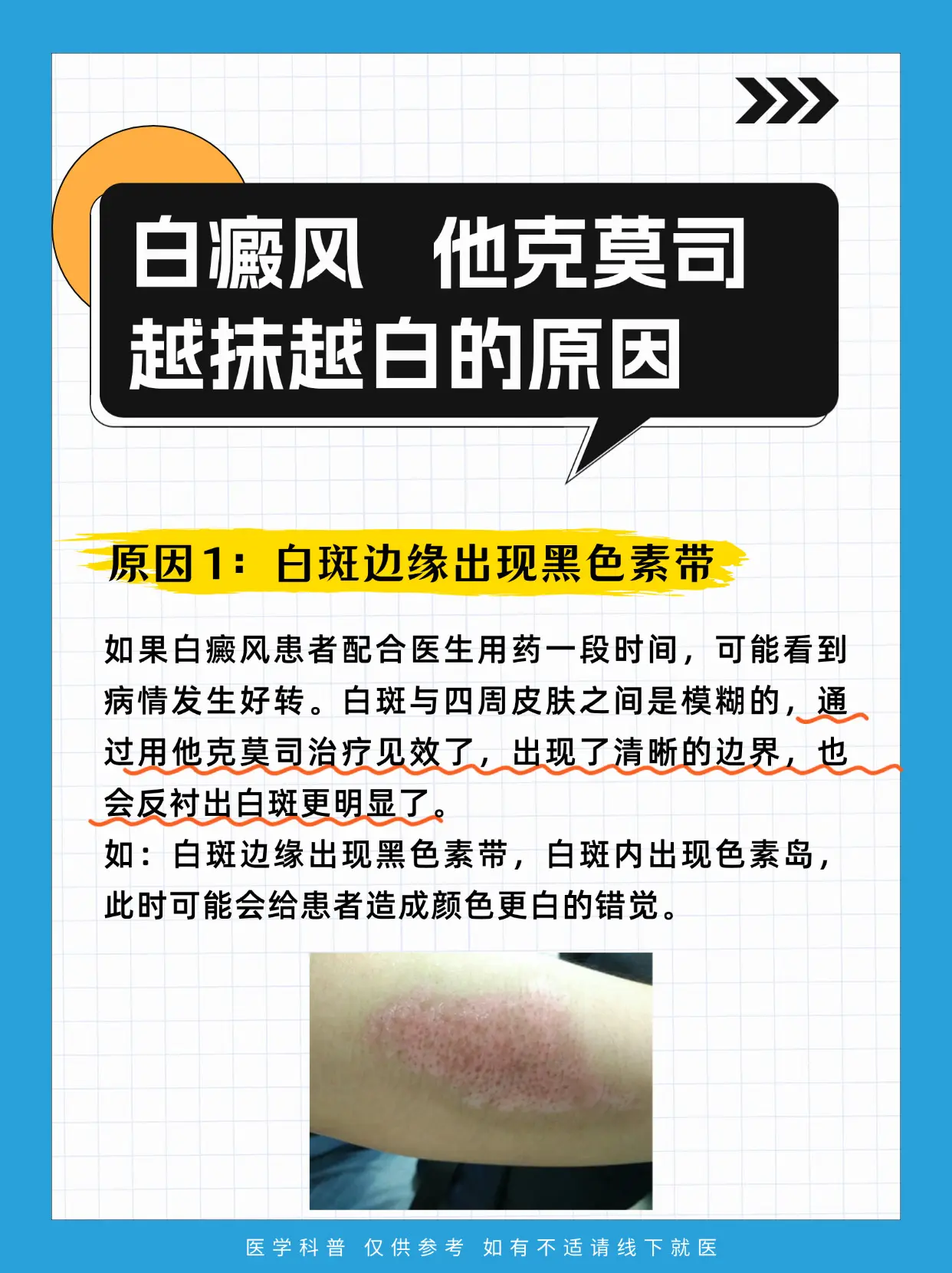 医学科普 白癜风 白癜风科普 硬核健康科普行动  医疗健康训练营
