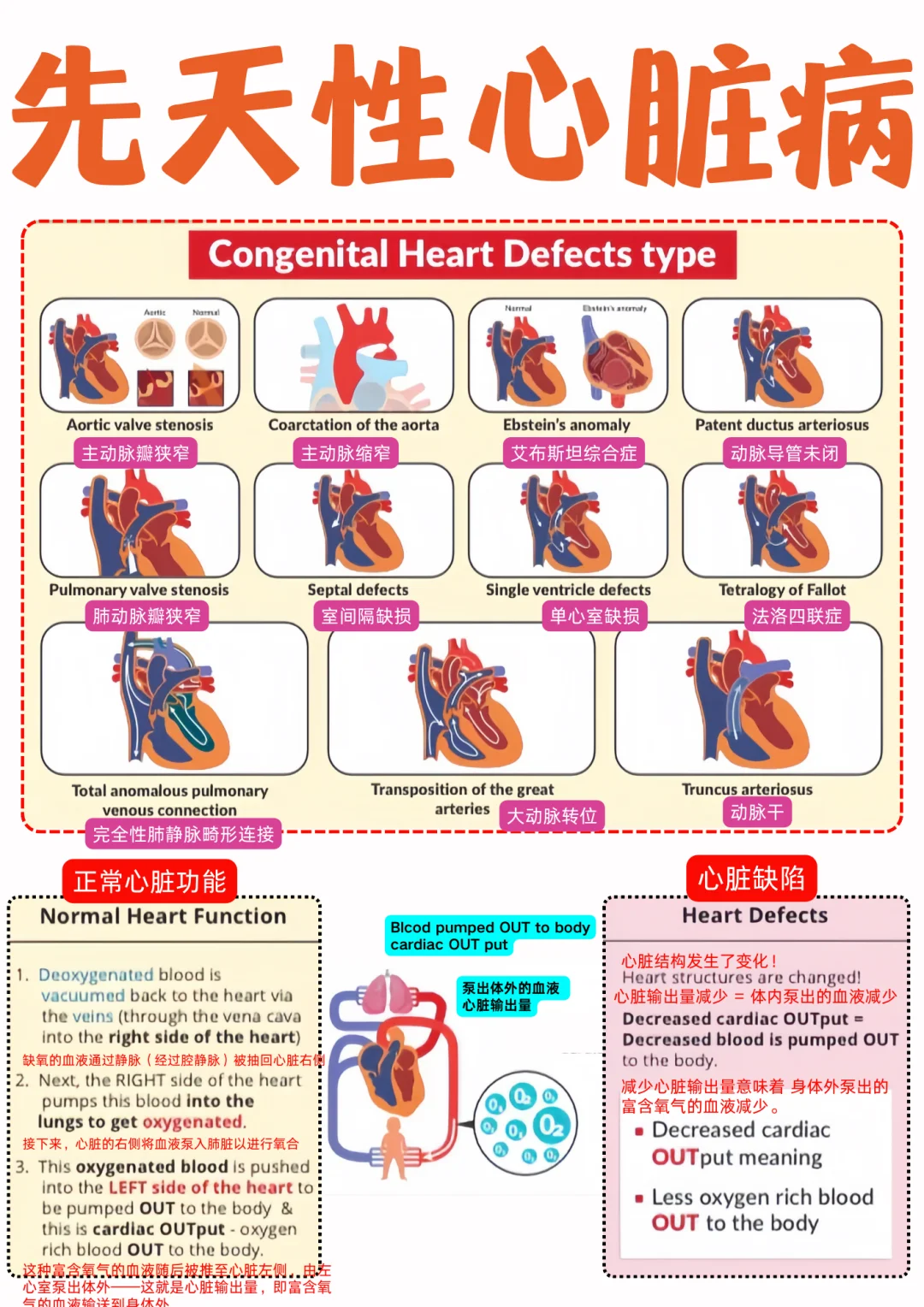 备考RN/先天性心脏缺陷！！学！！单词
