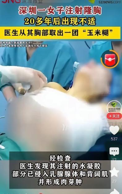 刷到一条新闻，看得我心里直发毛。6月25号深圳新闻网报道，深圳一个王女士，因为胸