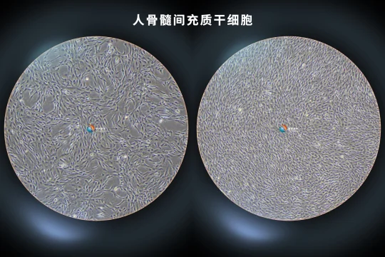 人骨髓间充质干细胞~太piu亮了💨