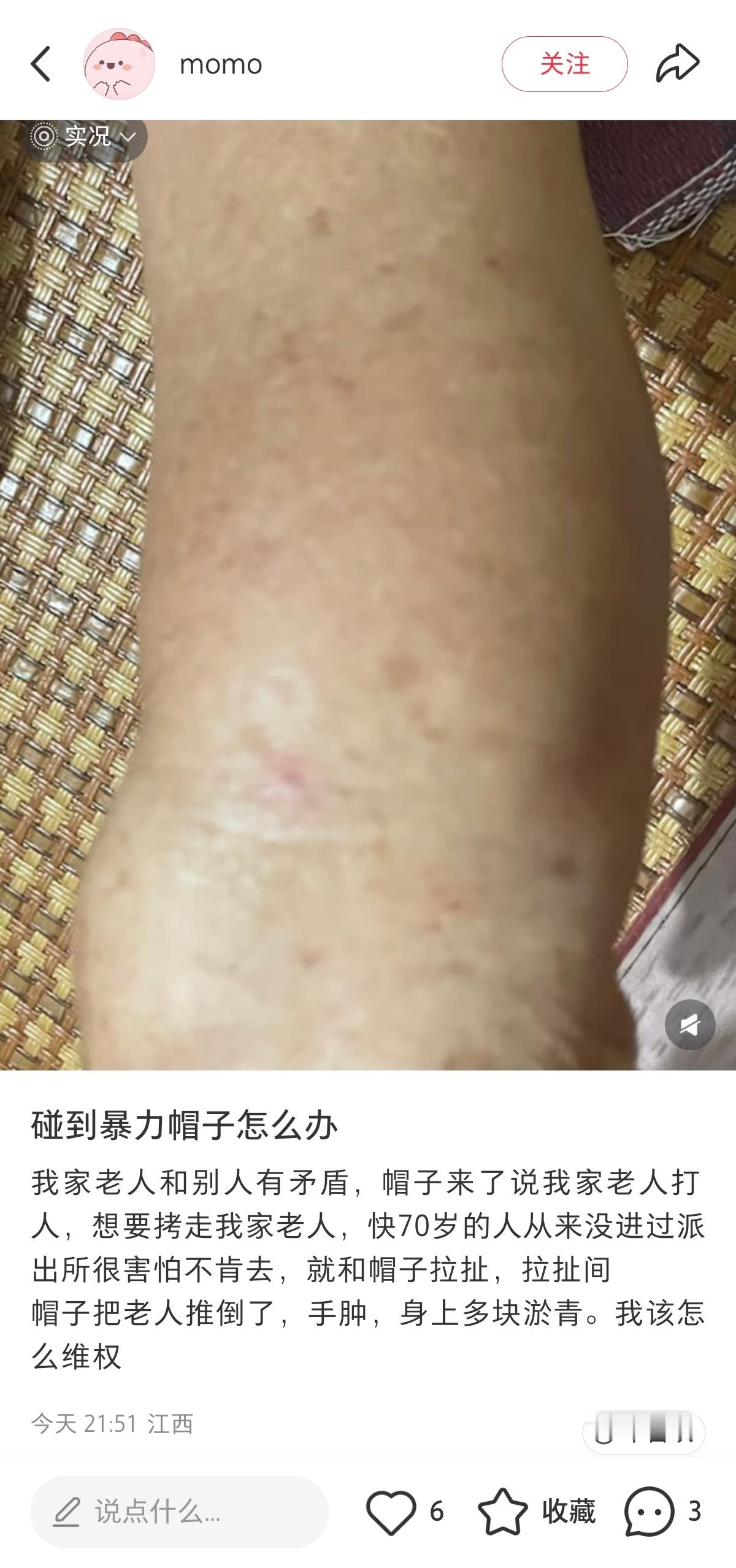 小红书确实人才多，殴打他人还拒捕敢说成警察暴力执法[无聊] ​​​