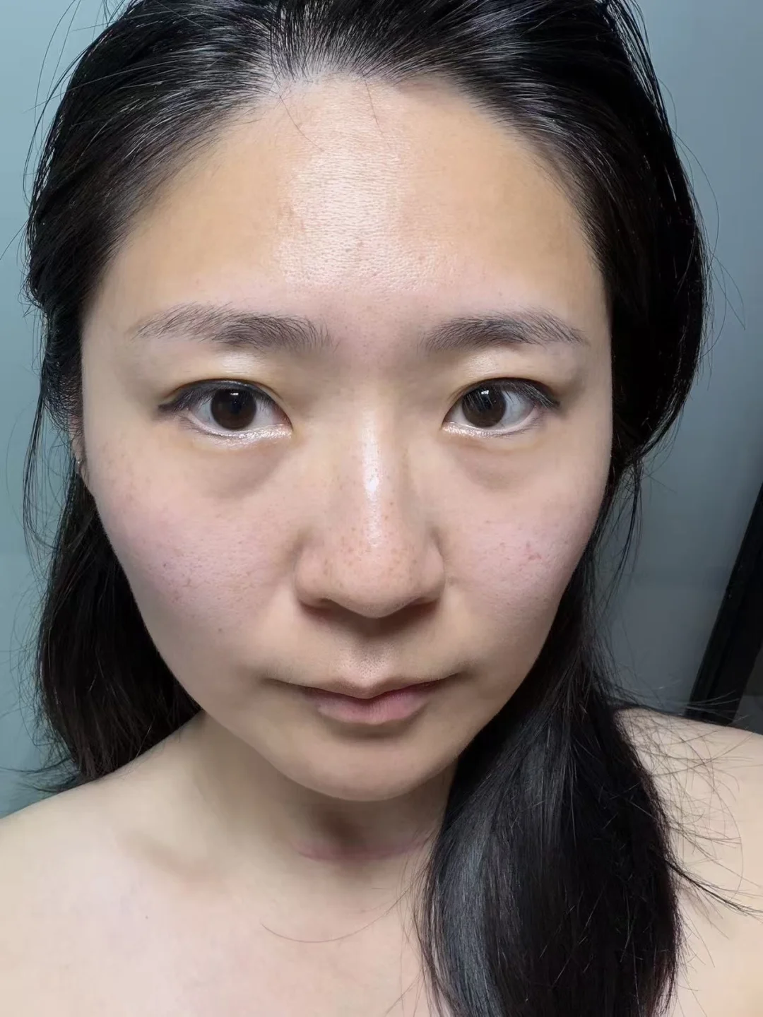 眼袋左滑一个月真实记录