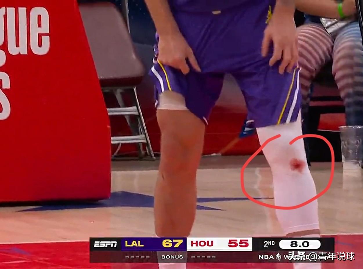 膝盖渗血！东契奇真拼啊！

今天客场再战火箭队的比赛，湖人队核心东契奇再度在防守