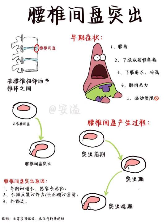 医学生绘本‖腰突太难受😣 试试这几招