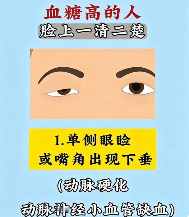 一套图看懂：血糖升高的 6 大面部征兆，对应血管神经损伤