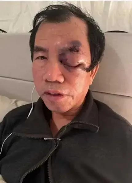 美国梦碎！退休领导梁新民遭白人男子暴力袭击，七旬高龄命悬一线，网友痛斥：这就是你