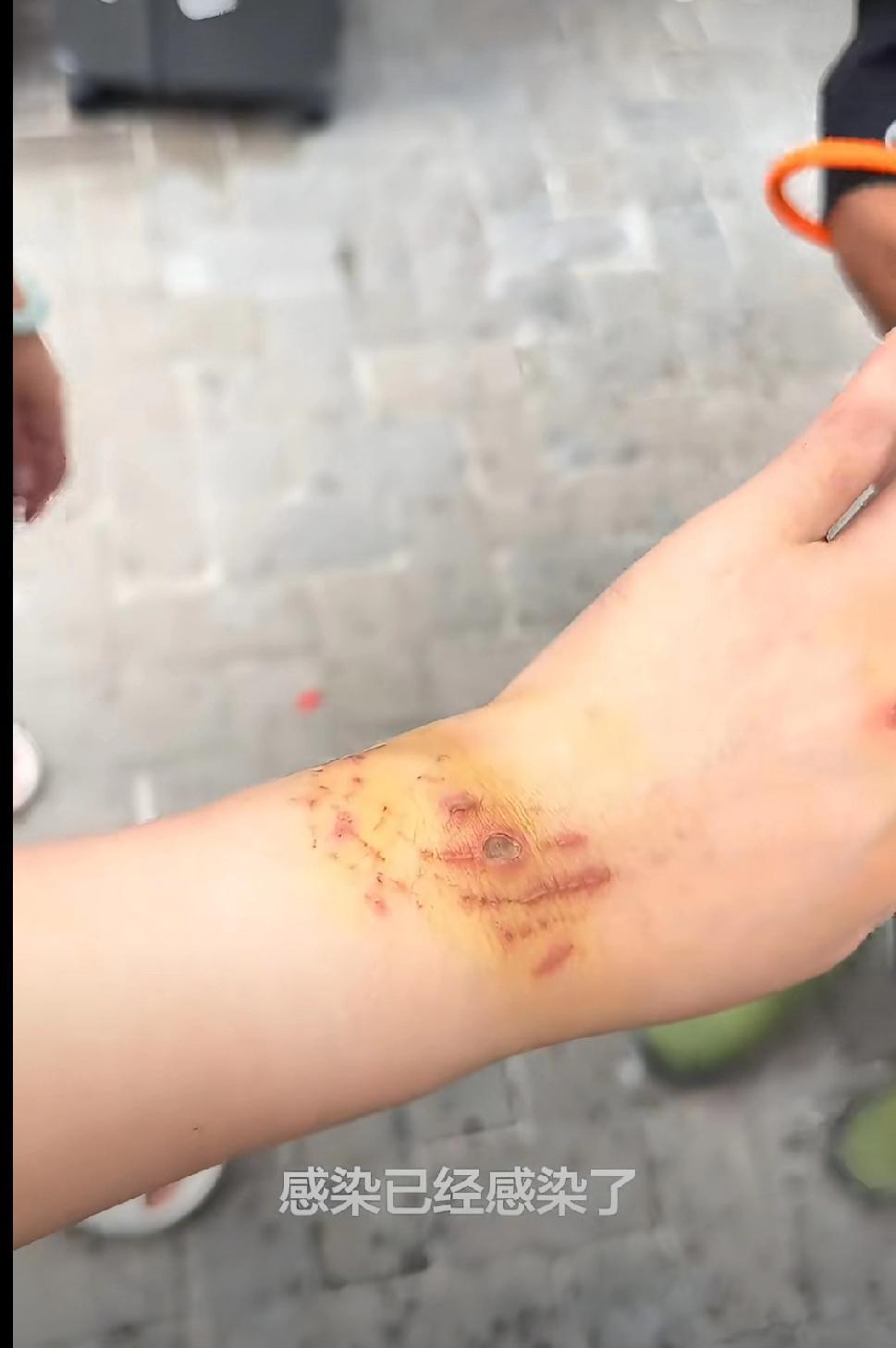 不知道咋说，网红为了流量，不顾生死，该说她努力呢，还是说她没有常识呢，这情况死亡