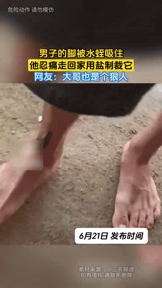 野外走路脚不幸被水蛭死死吸附，男子强忍疼痛步行回家，直接撒盐硬核处理，看完网友直