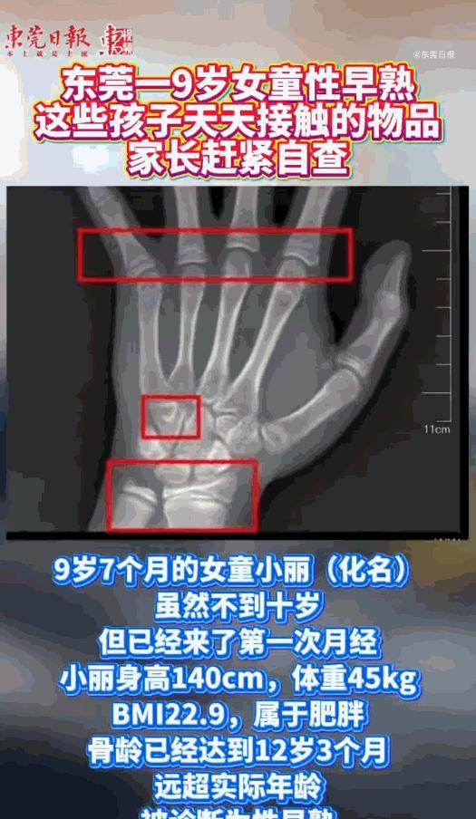 熬夜真是太可怕了！广东东莞，一个才9岁多的小女孩突然来了例假，吓得家长赶紧带着去