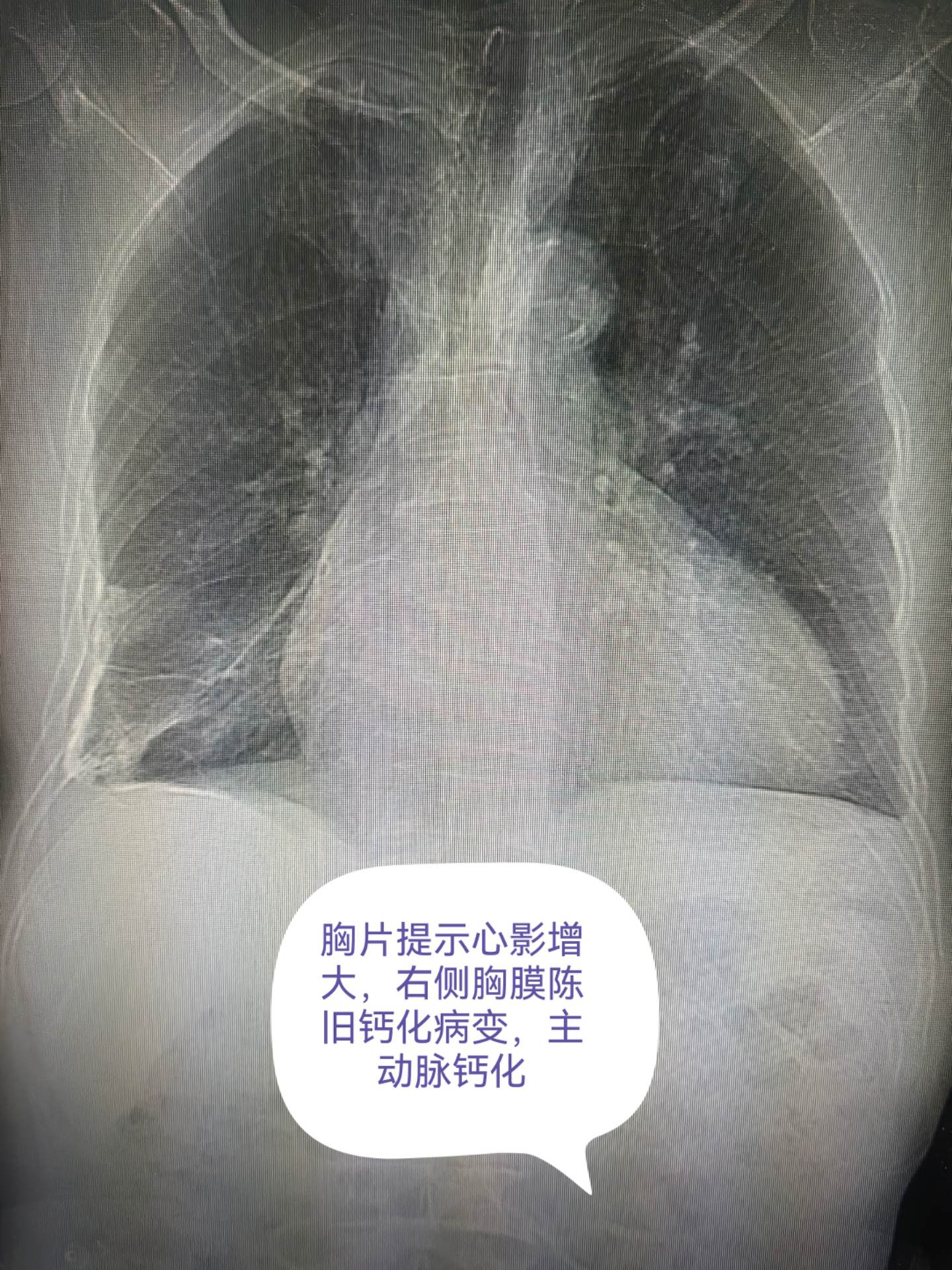 医学影像