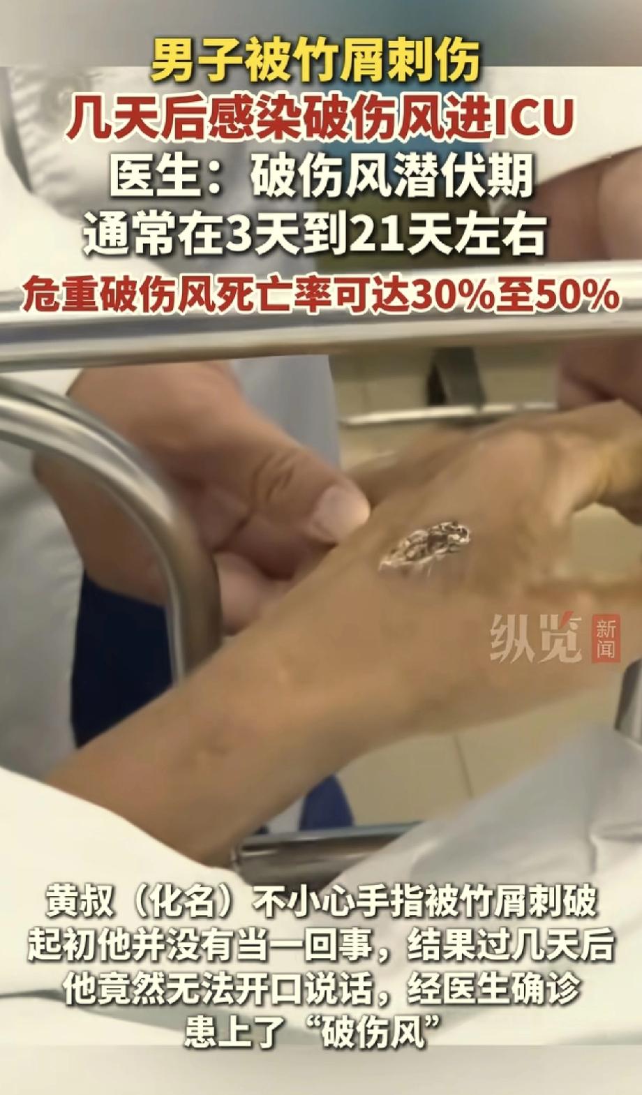 悲剧还是发生了！广东，一男子干农活时手背被竹屑扎伤，因为伤口很小，他并没有在意。