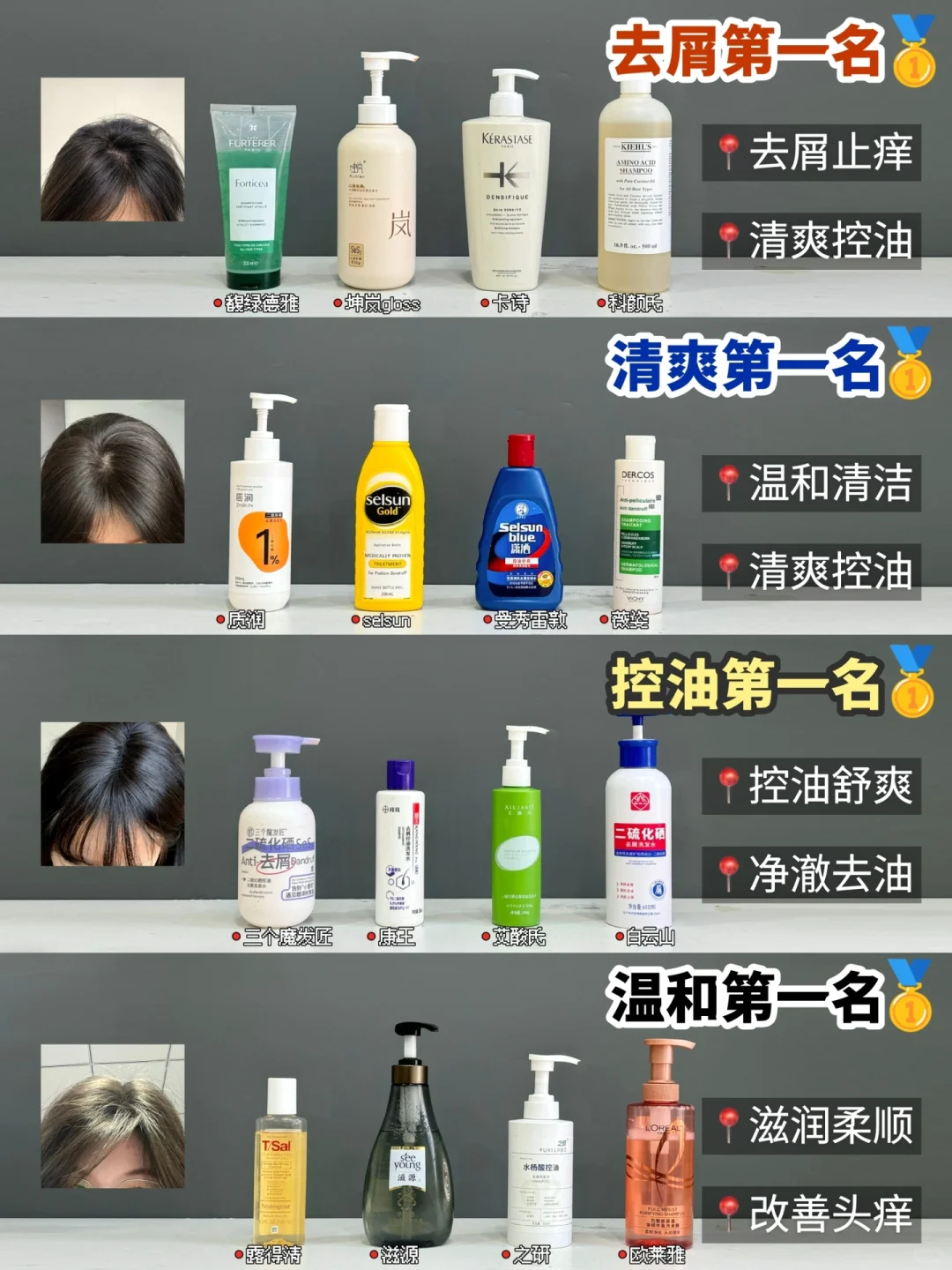 关于去屑洗发水的真相！油屑头最早知道越好