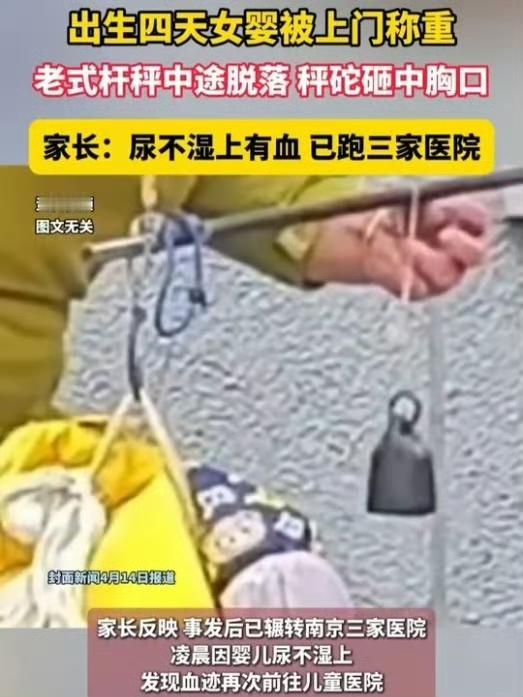 出生4天的女婴被秤砣砸中，还三次尿血，这事儿太揪心了。在南京江浦街道社区卫生服务