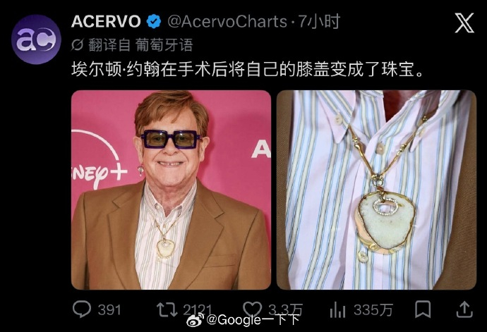 男明星把膝盖做成了珠宝 ？？ 