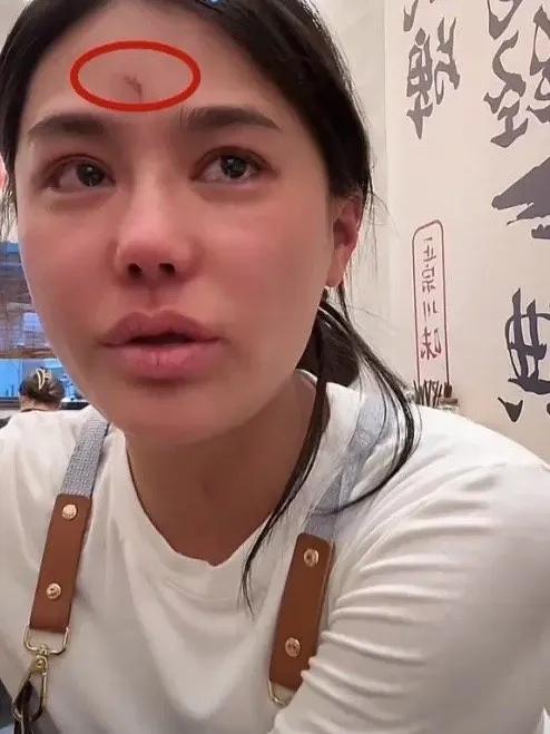 抖音千万粉丝网红樊小慧昨天直播哭诉称自己被前婆婆和前夫殴打，自己前夫一家已经因为