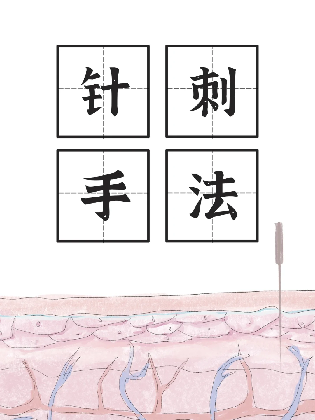 🌟下针的法则