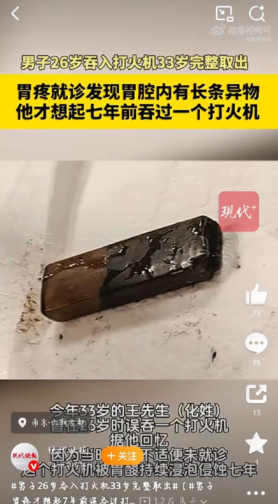 胃镜下可见打火机外壳已被胃酸浸泡得严重腐蚀老化，一旦破裂会导致内部丁烷液体泄漏，