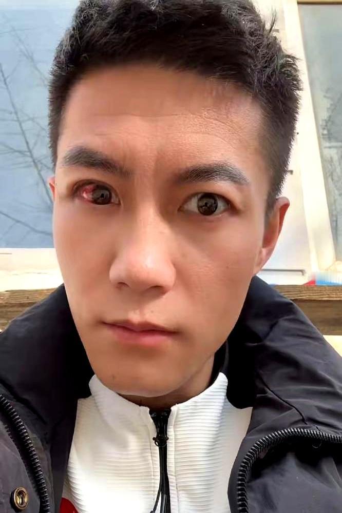 赵鸿刚打扇耳光赛输了还伤得不轻。他在沙特竞技场对阵哈萨克斯坦选手时，第三回合就被