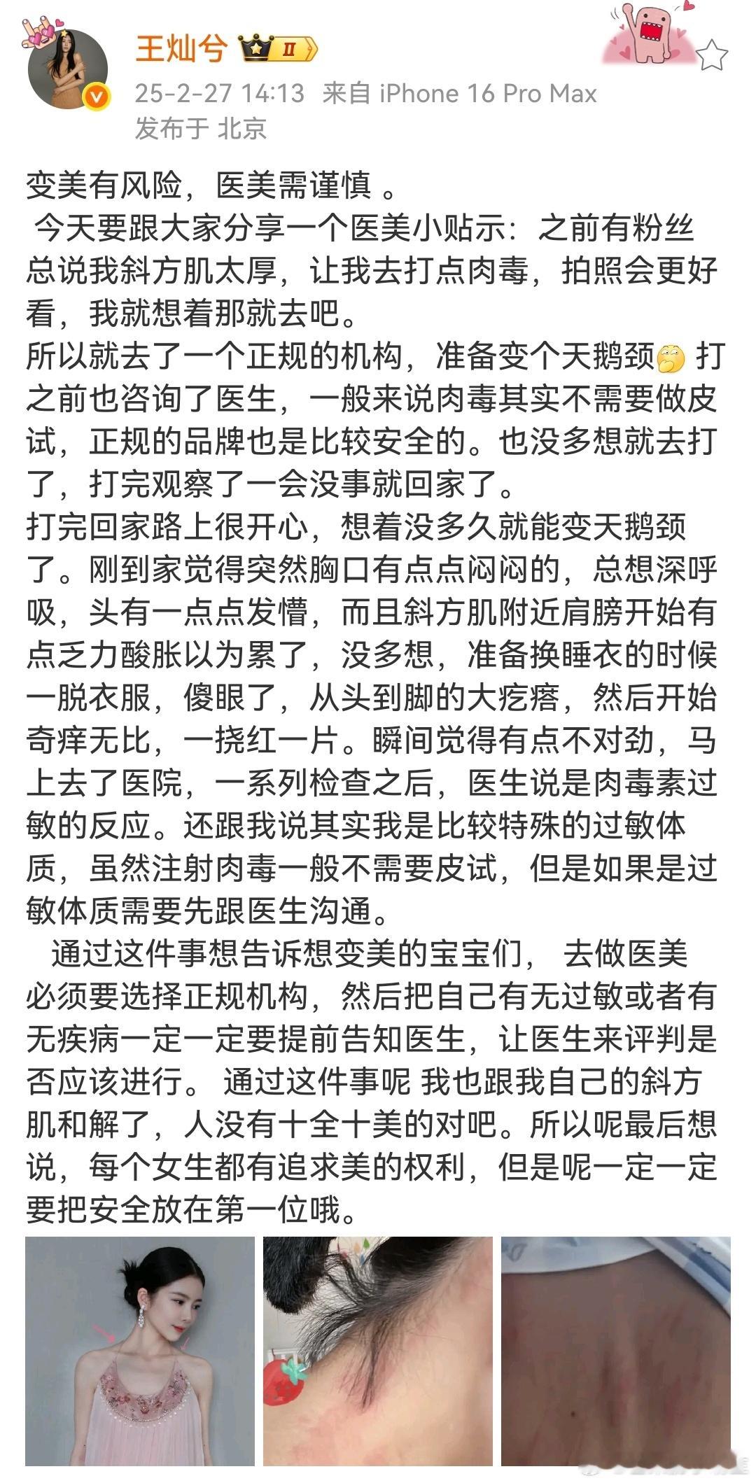 杜淳老婆打肉毒全身过敏  杜淳老婆自曝打肉毒全身过敏  杜淳老婆打肉毒导致全身严