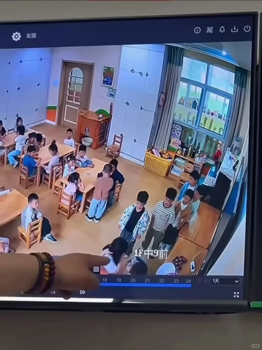 她嘴原来是幼儿园老师用热熔150度的胶枪嘴烫的 …