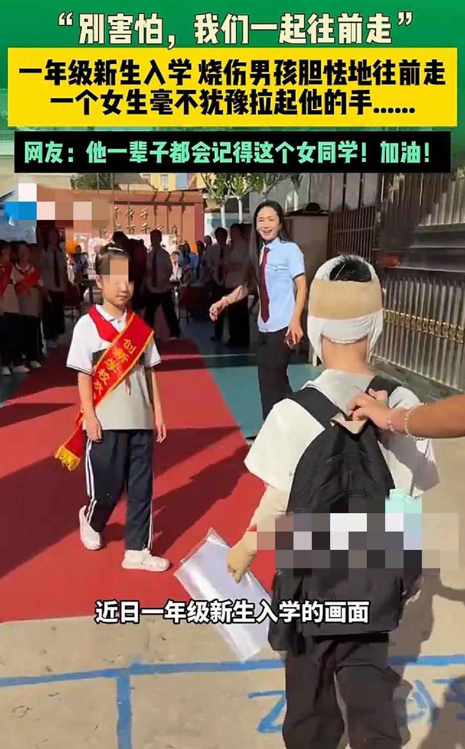 一男孩此前因遭遇煤气闪爆被烧伤，经过一整年的治疗后，才在新学期达到入学条件。而初