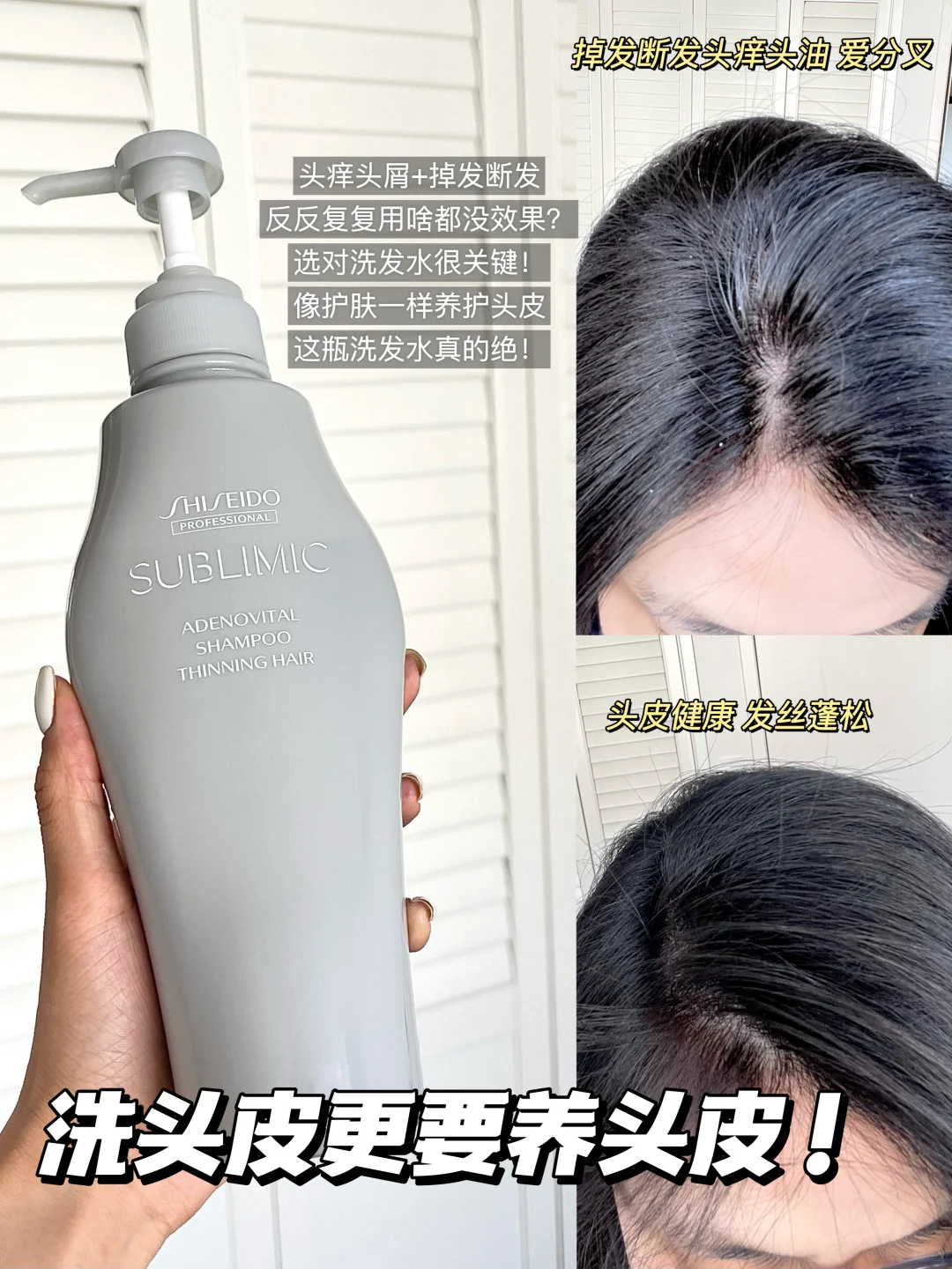 洗发圈的“精华水”？养护头皮是真的🐂！
