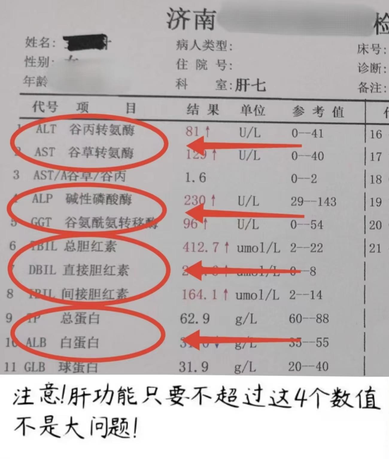 肝功能是反映肝损伤的重要指标，每个指标升高都代表相应的意义，但是主要的...