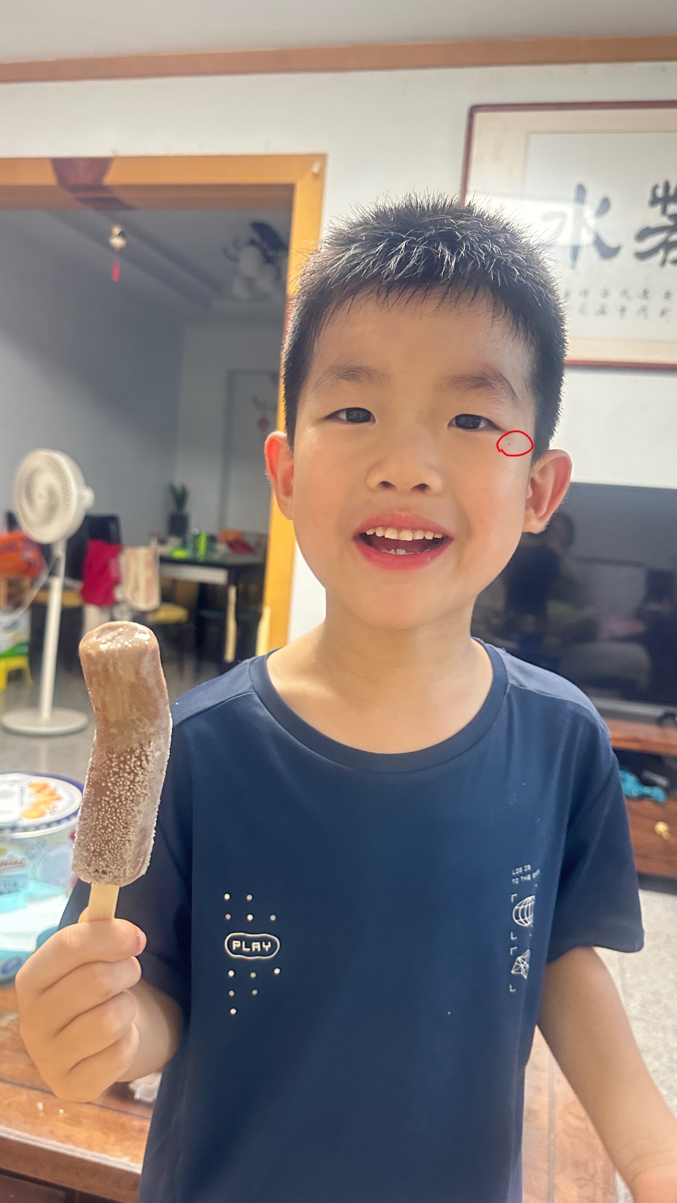 润润的脸上和胳膊上冒出了几个痣趁着还很小今天下午去医院和他去点了期间经历了嚎啕大