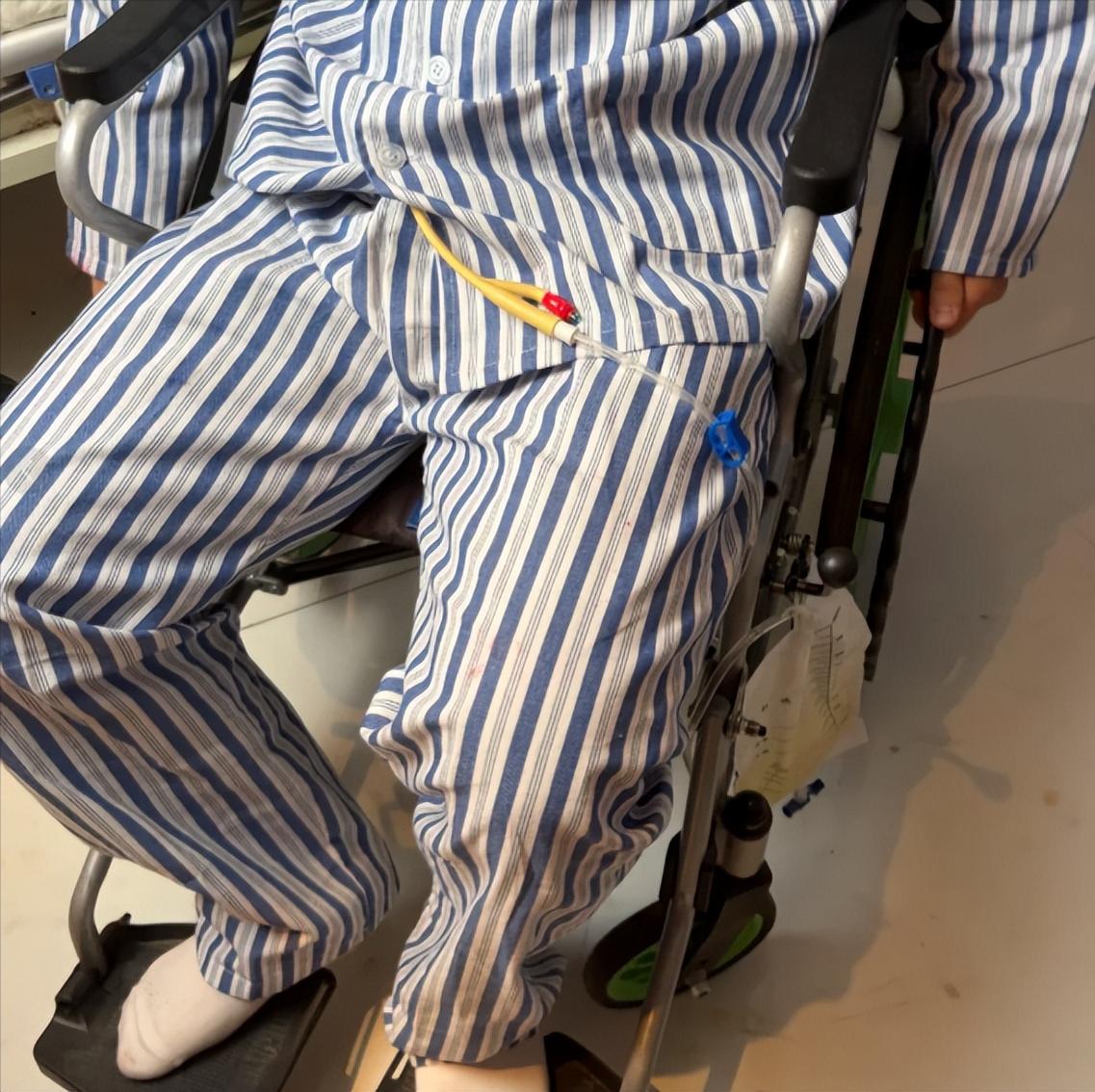 为什么天气一冷，脊髓损伤患者腿就发紧、抽筋？

大家好，我是神内郝主任。最近天气