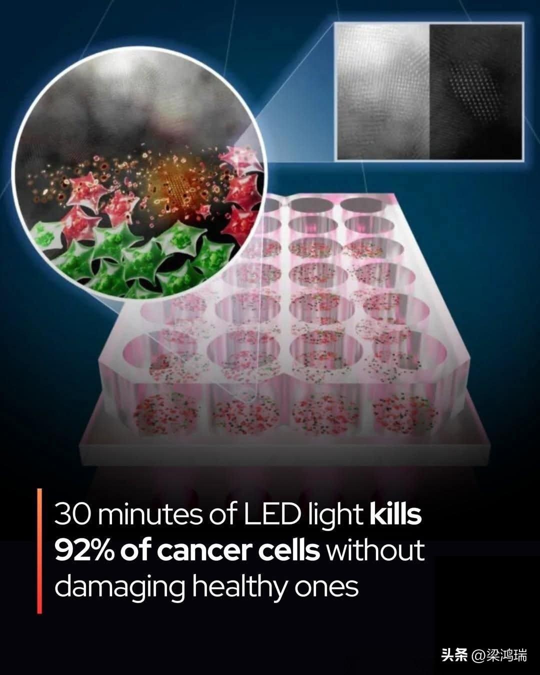 p一种新的癌症疗法利用 LED 光杀死 92% 的肿瘤细胞——无需化疗、无需辐射
