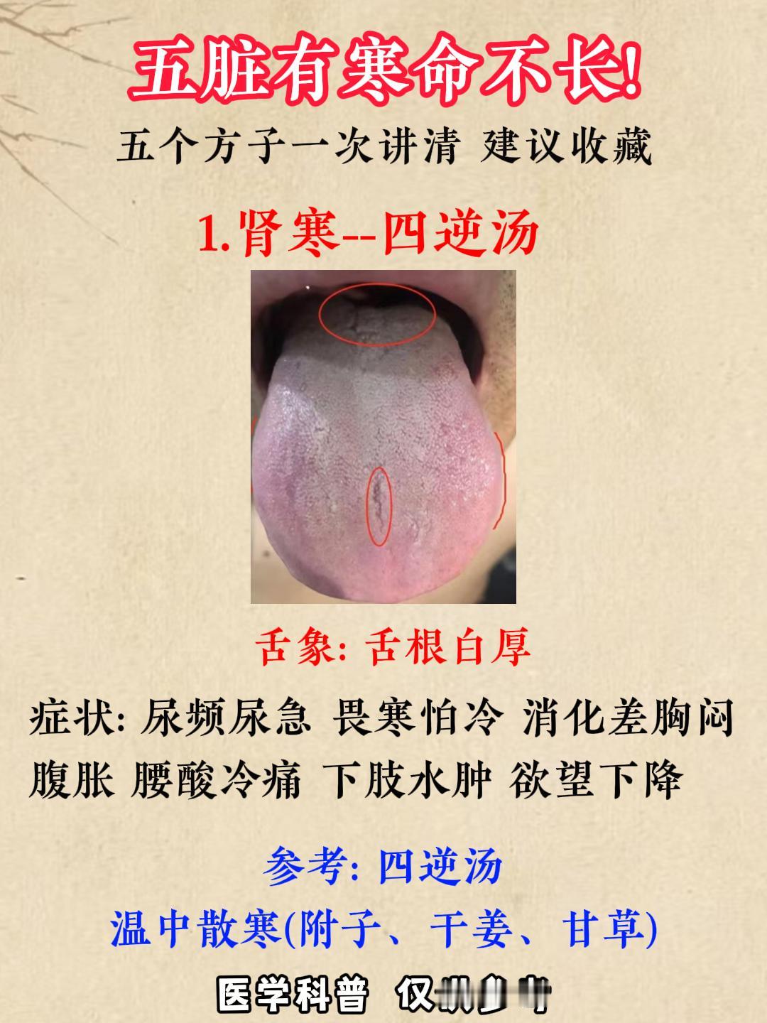 五脏有寒命不长！五个方子一次讲清，建议收藏！

1.肾寒--四逆汤
2.心寒--