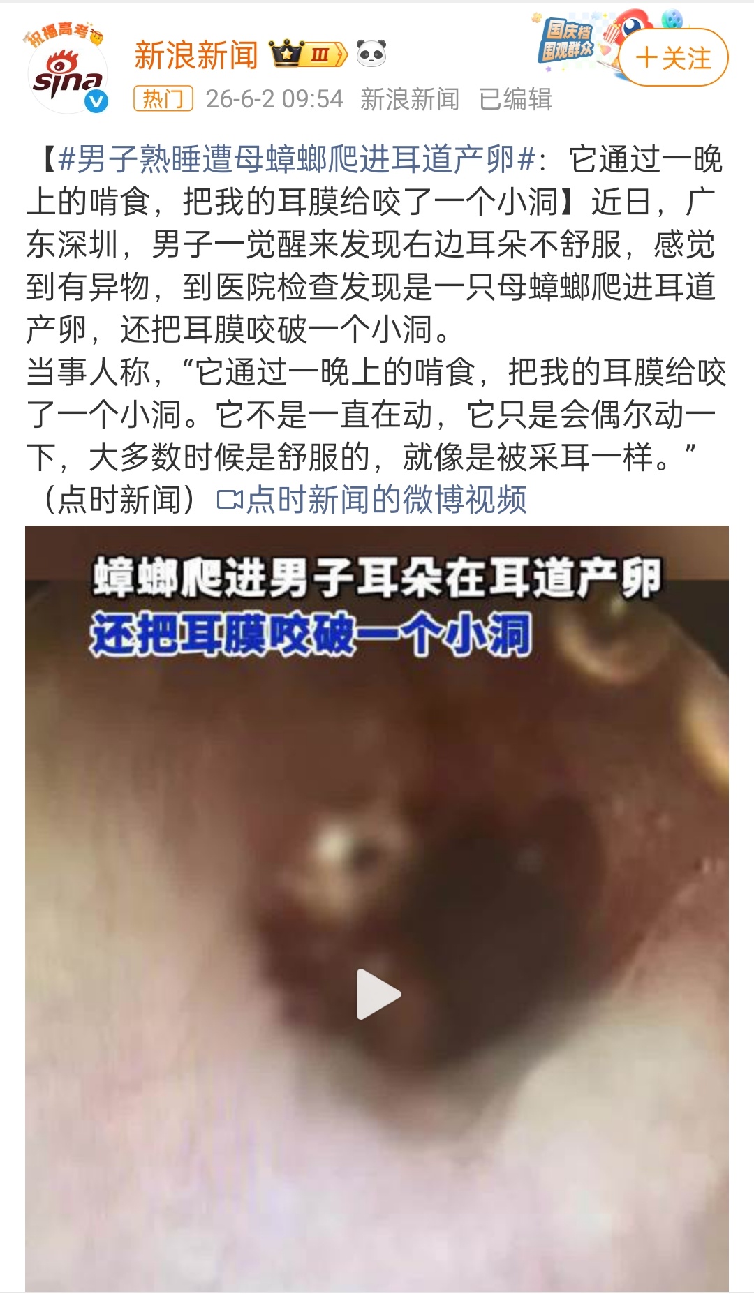 慎点，看得我头皮都炸了 