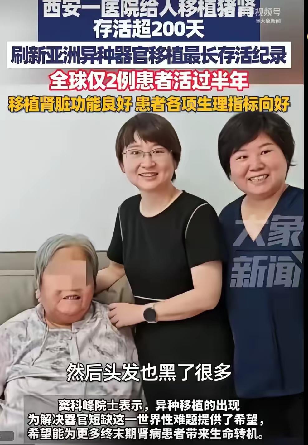 这下出名了，不知陕西西安，全国人民都知道了！

陕西西安一个医院给人移植猪肾存活