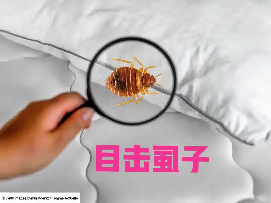 虱子！[白眼]
注意，它有时候是“侦探”！

小时候，家里又穷又破，个人卫生条件