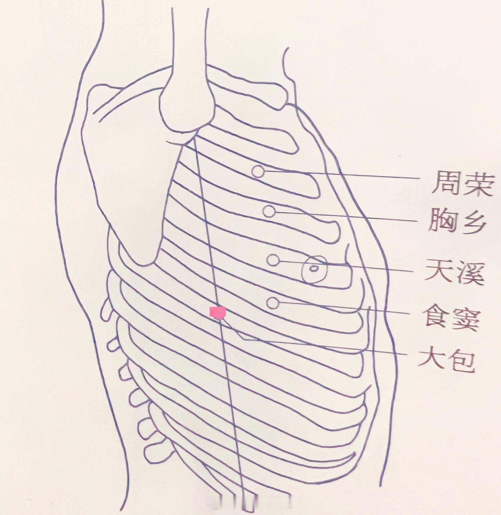 乳腺纤维瘤，掌根压在大包穴上，向膻中穴方向发力，推2-3分钟，每天都坚持，这是一