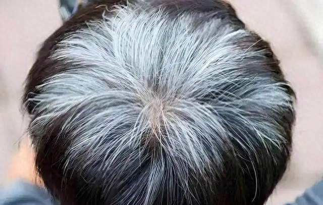 寿命长不长，头发先知？60岁后，白发少的人活得更久？告诉你答案