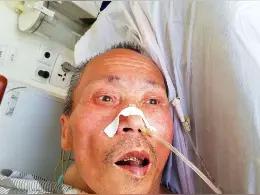 事件速览：重庆巫山老人被误判死亡事件（2026年5月） 
 
事发时间：5月1日
