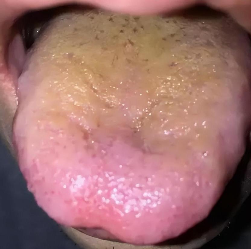 内热是频繁生病的祸根！中医：越是体内积热严重的人，越容易出现问题！

比如说上火