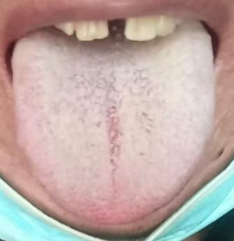 宗筋失养状态欠佳？根源或许是气血通行不畅







经常有人会问到：顽固性的