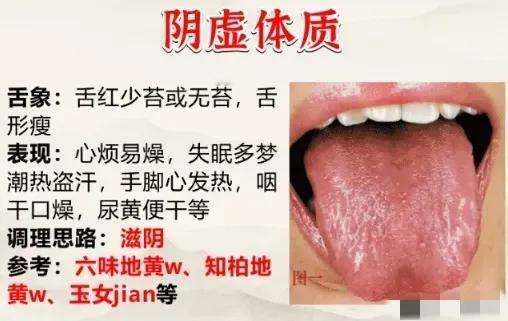 想知道如何调理身体吗？今天带你了解人体常见的9大体质及其对应的调理方法！

不同