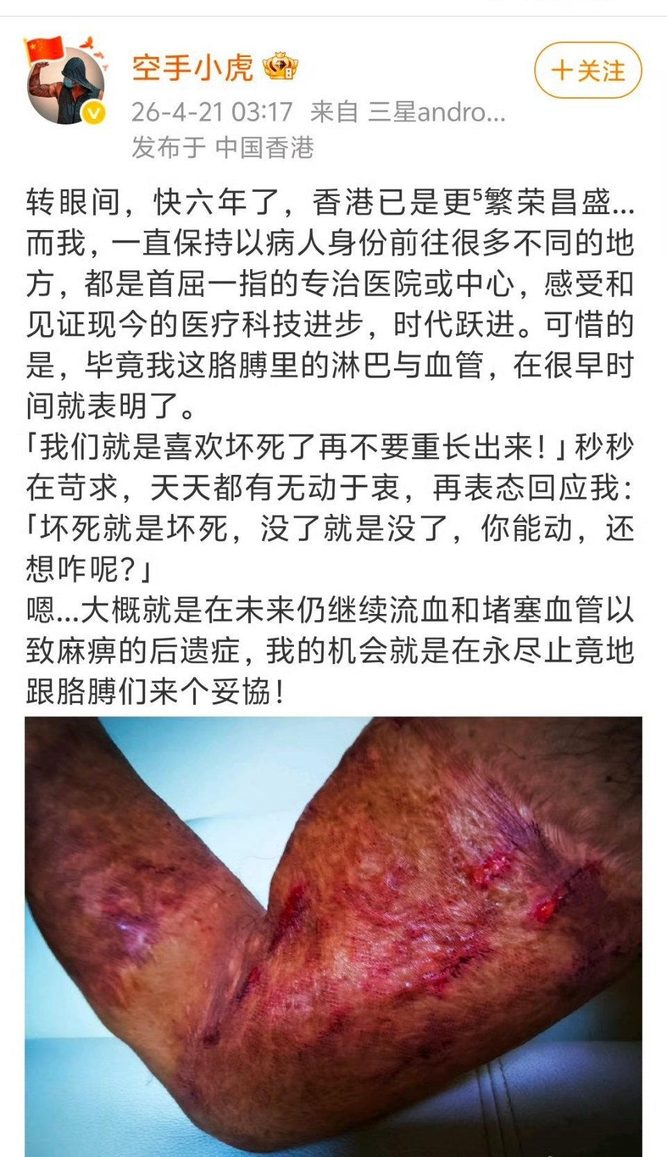 所以说决不能允许 张敬轩在大陆复出，允许他复出 就是对爱国者的侮辱！ 