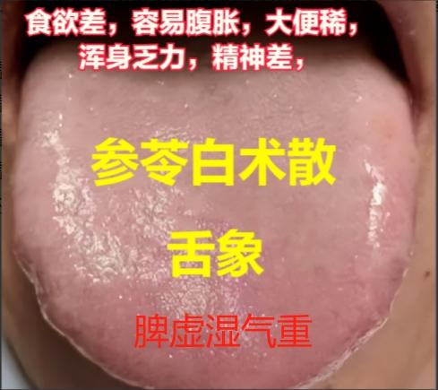 辨别你是那种湿，体内湿气重的人一定要收藏起来。#舌象分析##中医辨证#