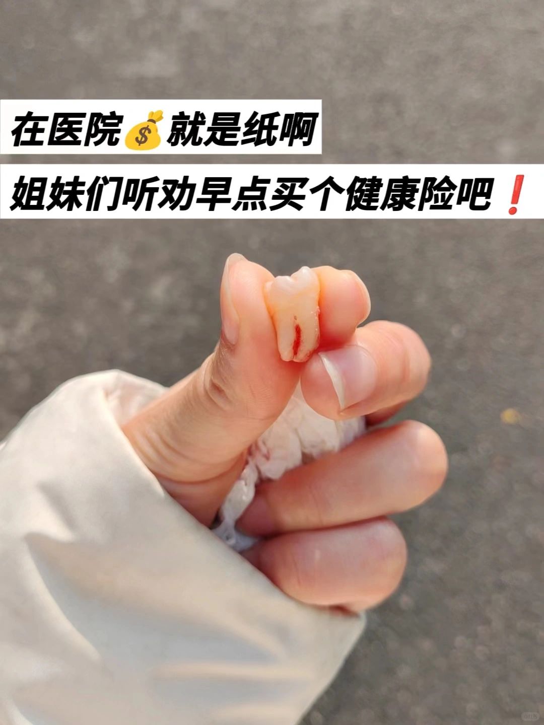 有了社保也要买百万医疗险❗️打工人进