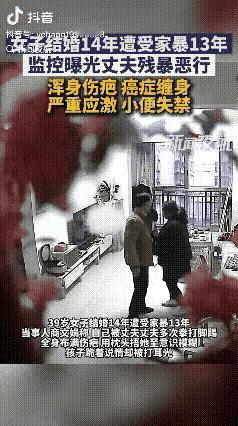 对自己的妻子如此施暴，这样的男人就应该绳之以法，好好的一个女人，被折磨成这个样子