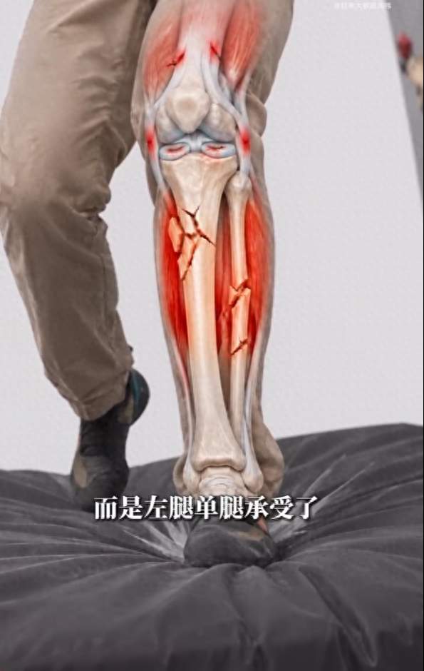 “红衣大叔”的膝盖，和企业家最后的较劲