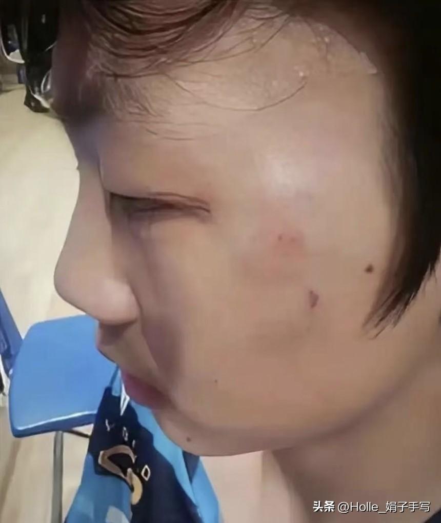 令人震惊!曹彦灏被对手打了一个11比0，他恼羞成怒，气急败坏，出手殴打了对方！已