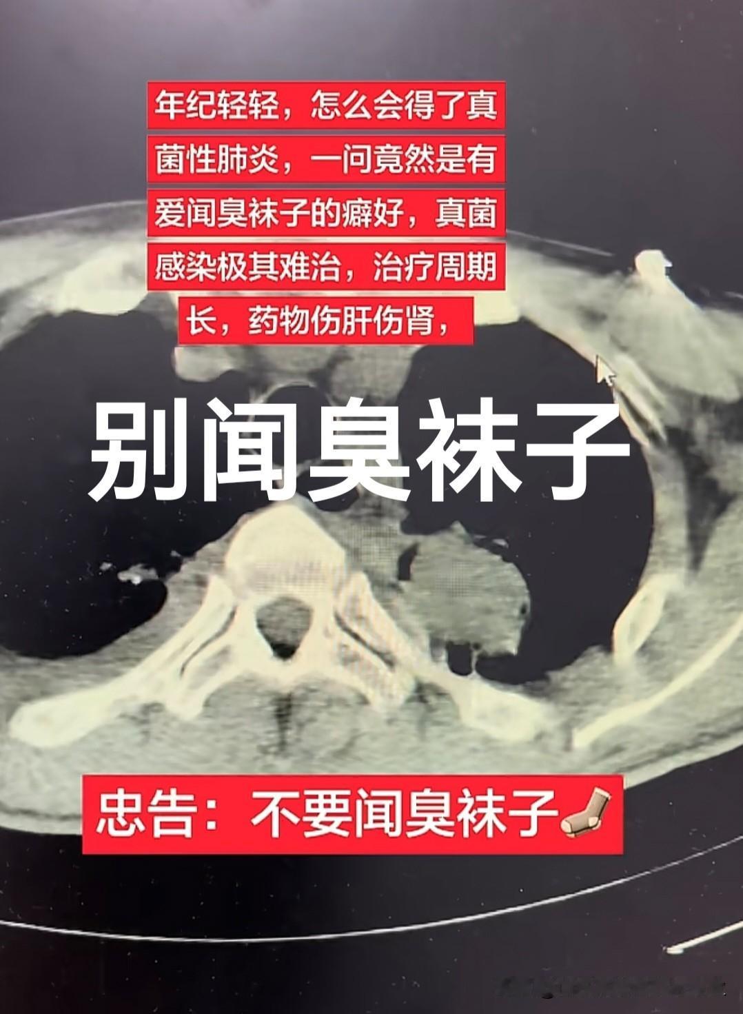 改掉这个坏习惯：闻闻袜子臭不臭？不要闻，也不要放在离床头近的地方。看看下图的结果